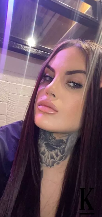 stories-slider-content