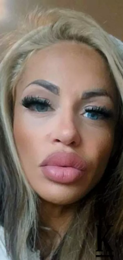 stories-slider-content