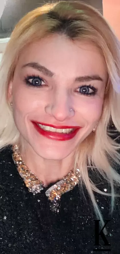 stories-slider-content