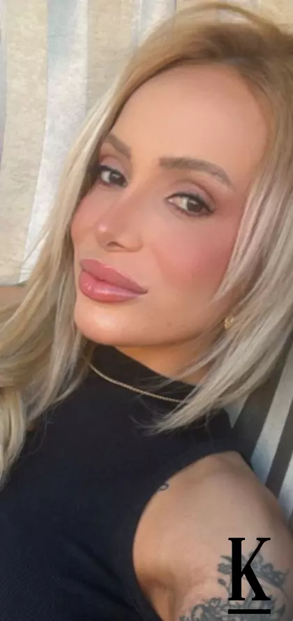 stories-slider-content