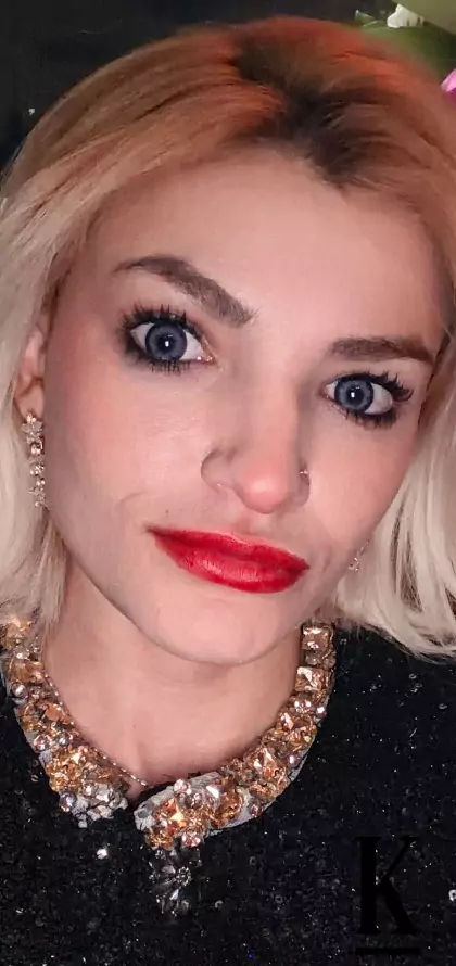 stories-slider-content