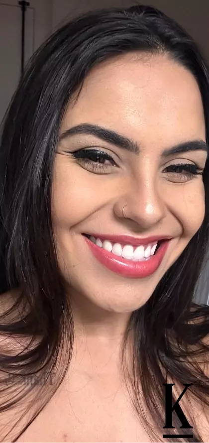 stories-slider-content