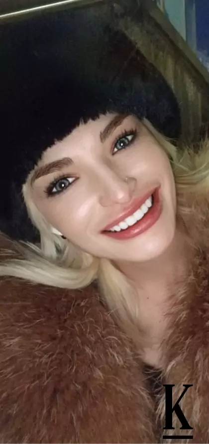 stories-slider-content