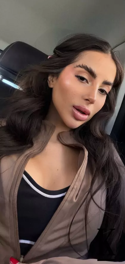 stories-slider-content