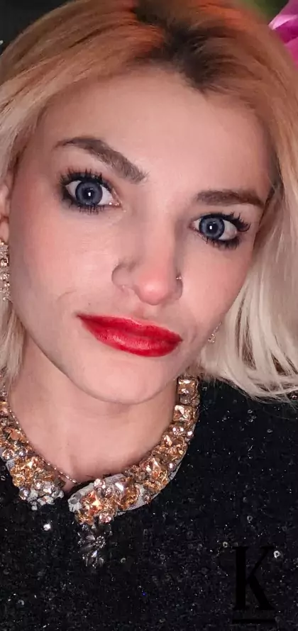 stories-slider-content