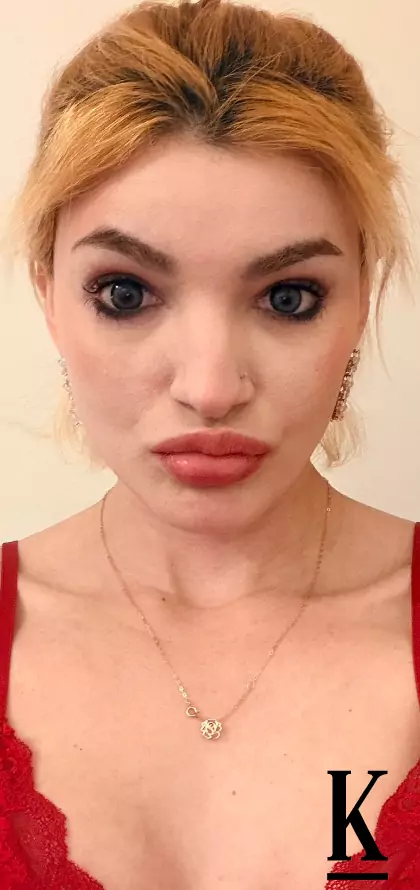 stories-slider-content